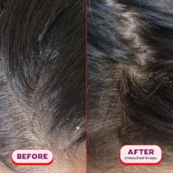 UNEARTH YOURSELF Balancing Clay Hair Cleanser 19 UNEARTH YOURSELF Balancing Clay Hair Cleanser -Fashion Makeup & Care 4 MICROSCALP