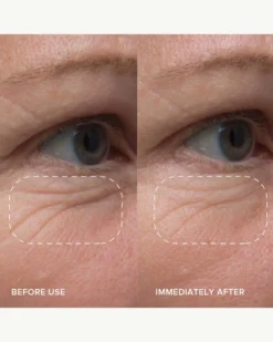 PlantGenius Line-Filling Eye Balm With Bakuchiol -Fashion Makeup & Care AlpynBeauty PlantGeniusLine FillingEyeBalm BeforeAfter 03 scaled