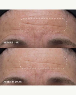 PlantGenius Melt Moisturizer -Fashion Makeup & Care AlpynBeauty PlantGeniusMeltMoisturizer BeforeAfter 03 scaled