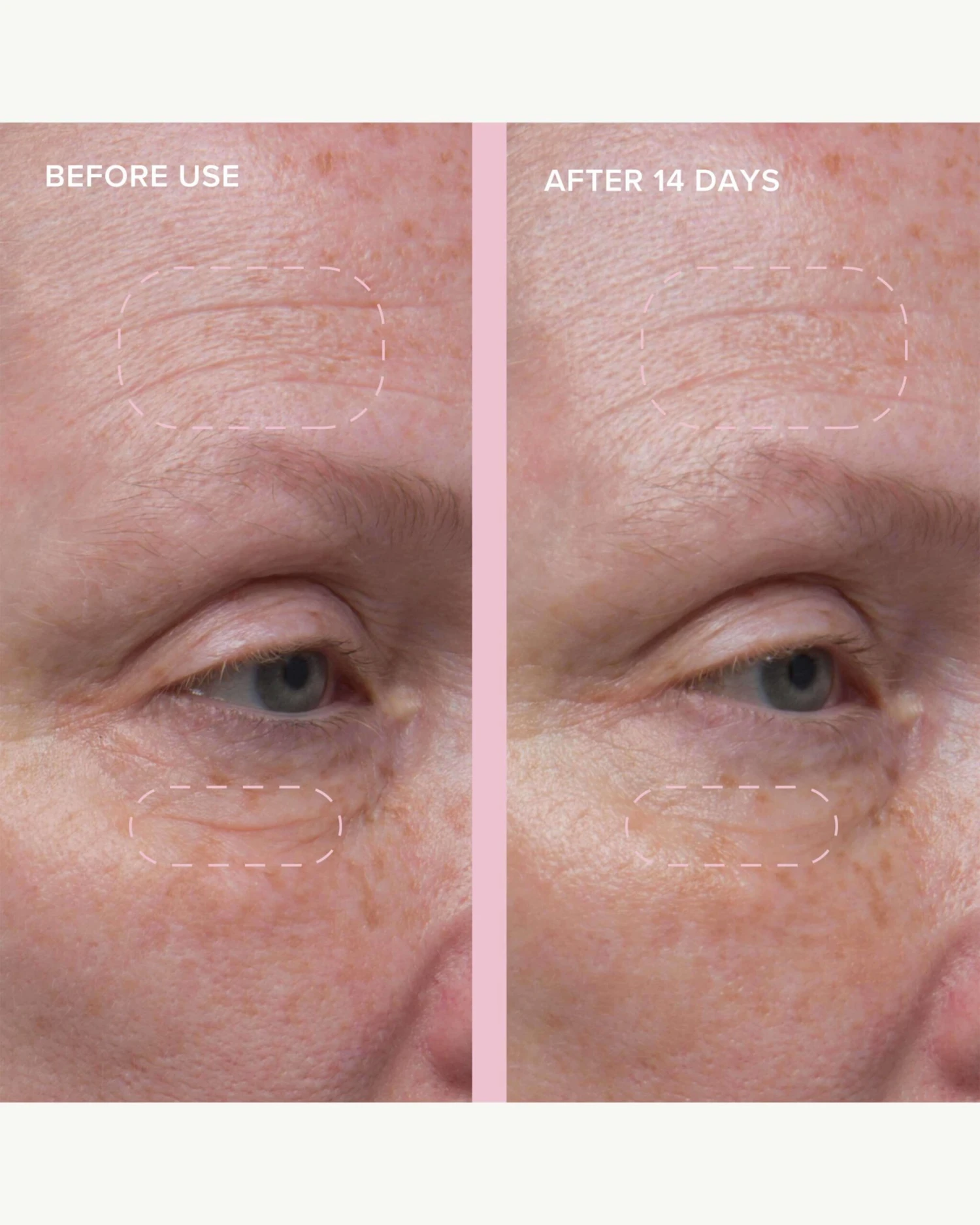 Wild Nettle & Niacinamide Firming Serum 3 Wild Nettle & Niacinamide Firming Serum - Image 3