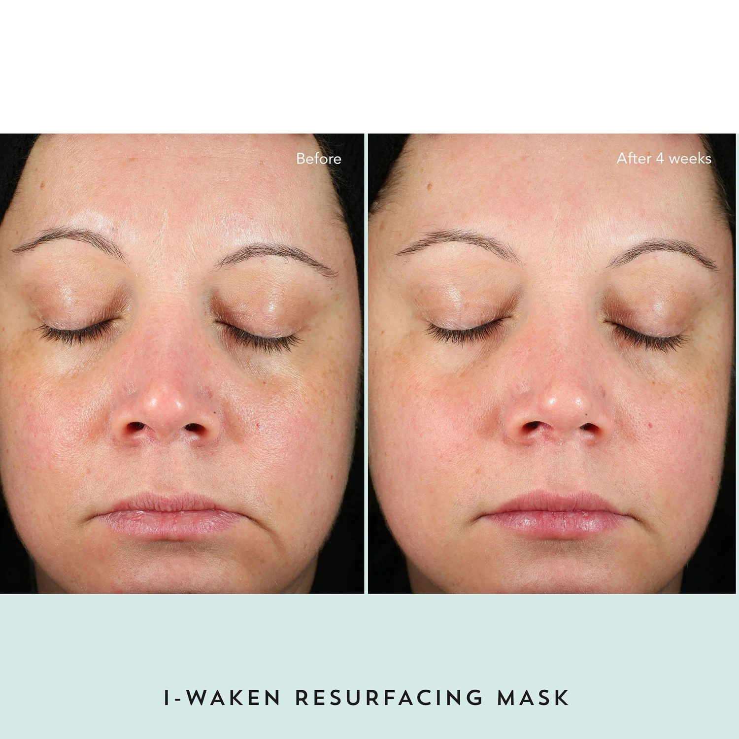 I-Waken Resurfacing Mask 8 I-Waken Resurfacing Mask - Image 8