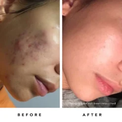 Blue Tansy Mask 14 Blue Tansy Mask -Fashion Makeup & Care BlueTansyMask BA Carley Ammonn Right 1600x2000 91b7c775 f07e 450a 80c5 9956f52f33ae