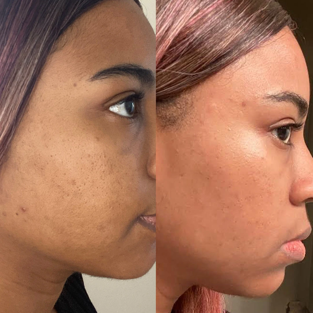 Blue Aura Cleansing Water 15 Blue Aura Cleansing Water - Image 15