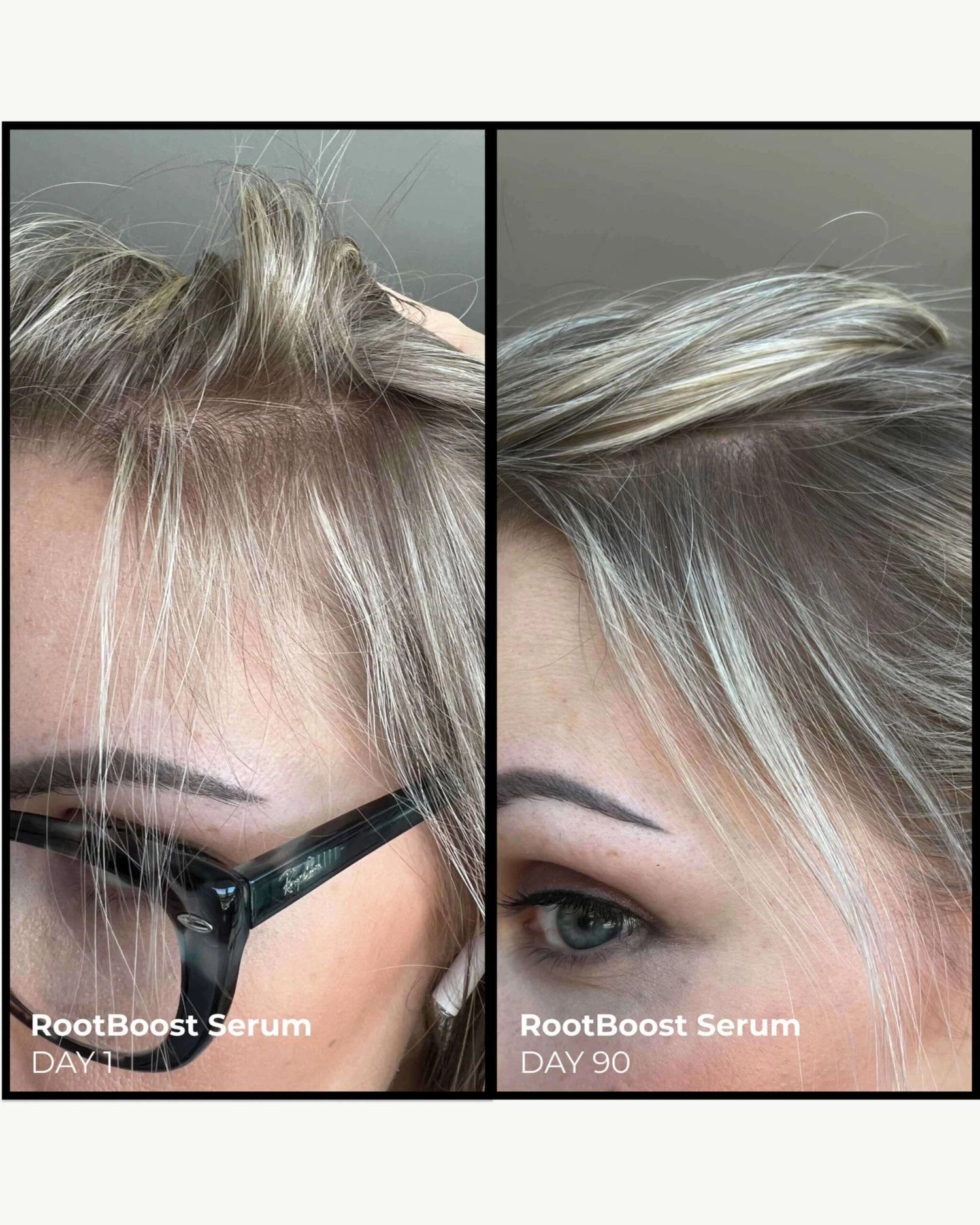 Better Roots RootBoost Serum 6 Better Roots RootBoost Serum - Image 6