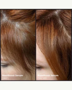 Better Roots RootBoost Serum 13 Better Roots RootBoost Serum -Fashion Makeup & Care EvolvH BetterRootsRootBoostSerum BeforeAfter 07 scaled