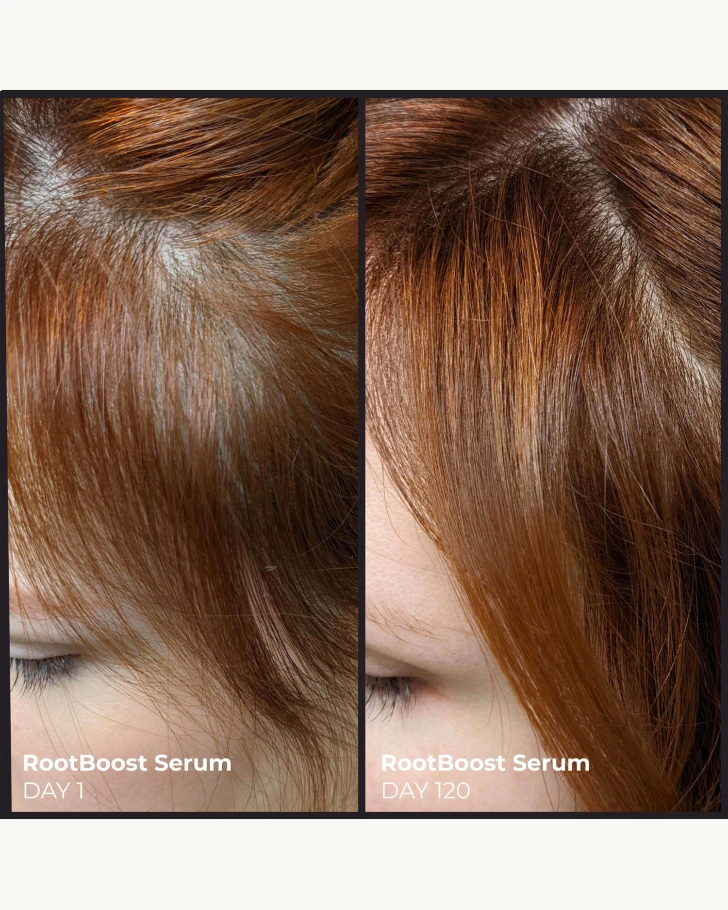 Better Roots RootBoost Serum 7 Better Roots RootBoost Serum - Image 7