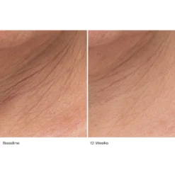 Plumbody™ Body Créme 20 Plumbody™ Body Créme -Fashion Makeup & Care LePrunier BA 12wk 019 front neck c