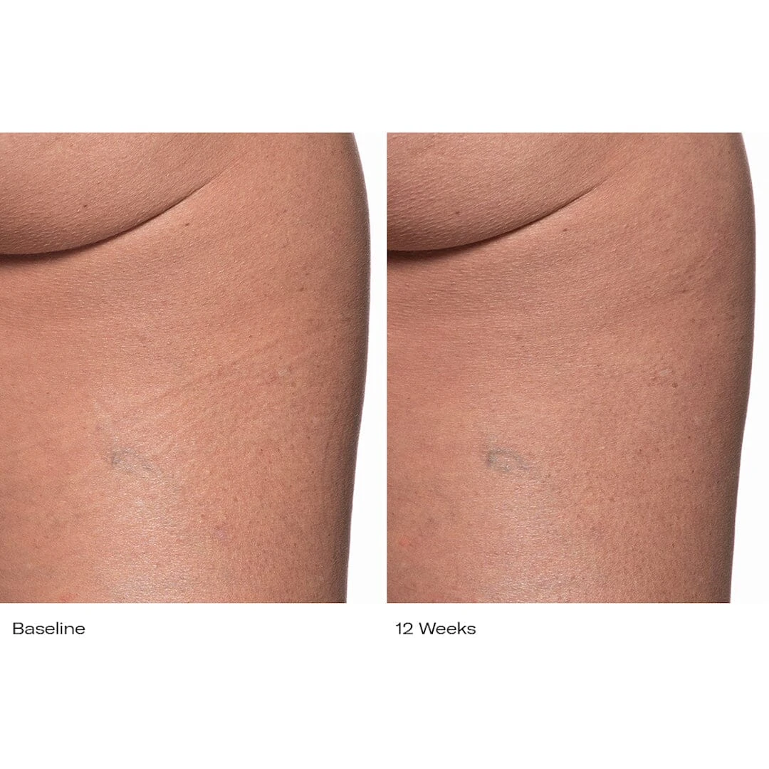 Plumbody™ Body Créme 6 Plumbody™ Body Créme - Image 6