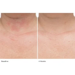 Plumbody™ Body Créme 17 Plumbody™ Body Créme -Fashion Makeup & Care LePrunier BA 4wk 032 front neck