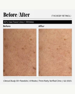 The Body Retinol 24 The Body Retinol -Fashion Makeup & Care Necessaire TheBodyRetinol BeforeAfter 11 scaled