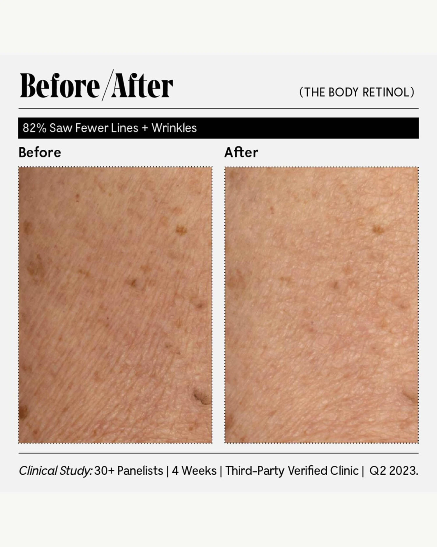 The Body Retinol 11 The Body Retinol - Image 11