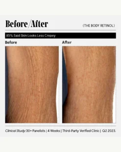The Body Retinol 25 The Body Retinol -Fashion Makeup & Care Necessaire TheBodyRetinol BeforeAfter 12 scaled