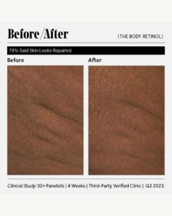 The Body Retinol 26 The Body Retinol -Fashion Makeup & Care Necessaire TheBodyRetinol BeforeAfter 13 scaled
