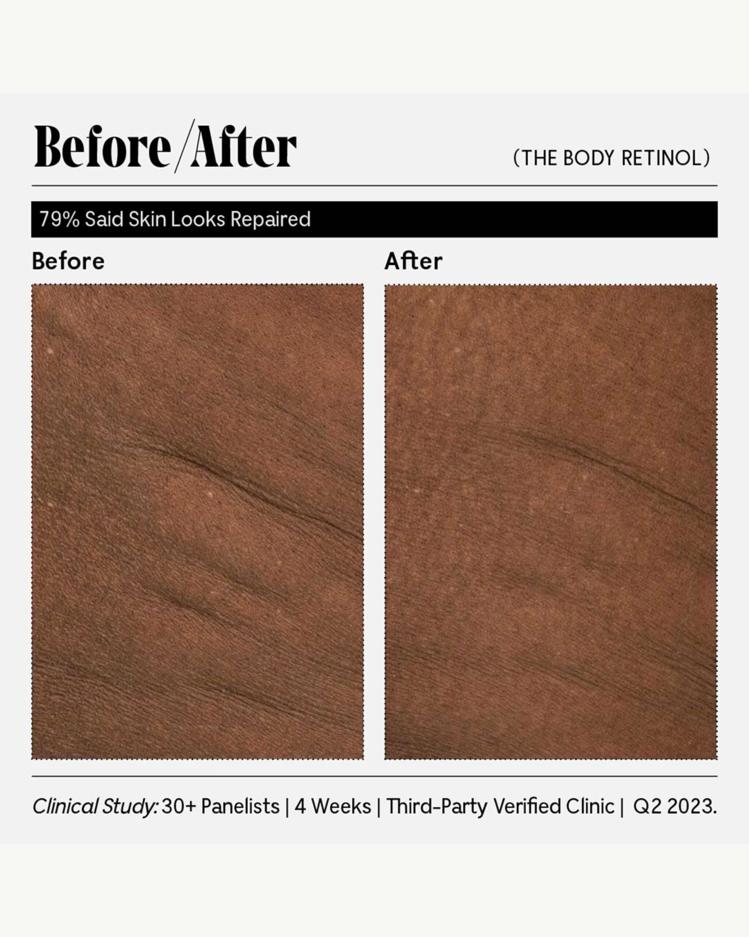 The Body Retinol 13 The Body Retinol - Image 13