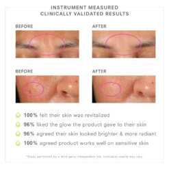 PREBIOTIX™ Freshly Squeezed Glow 20% Vitamin C Serum 9 PREBIOTIX™ Freshly Squeezed Glow 20% Vitamin C Serum -Fashion Makeup & Care PDP block Clinical Results PBX VitC