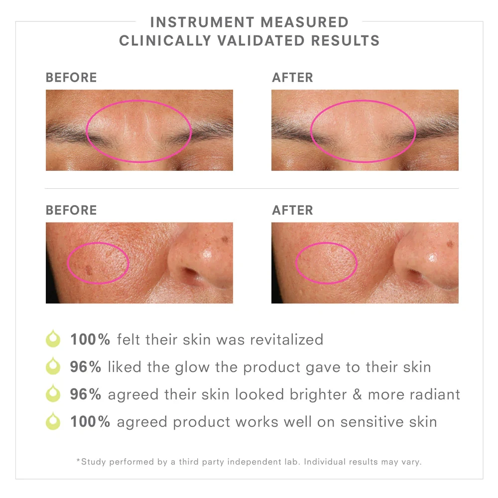 PREBIOTIX™ Freshly Squeezed Glow 20% Vitamin C Serum 5 PREBIOTIX™ Freshly Squeezed Glow 20% Vitamin C Serum - Image 5