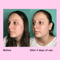 Pimple Paste Overnight Drying Paste -Fashion Makeup & Care PIMPLEPASTE5