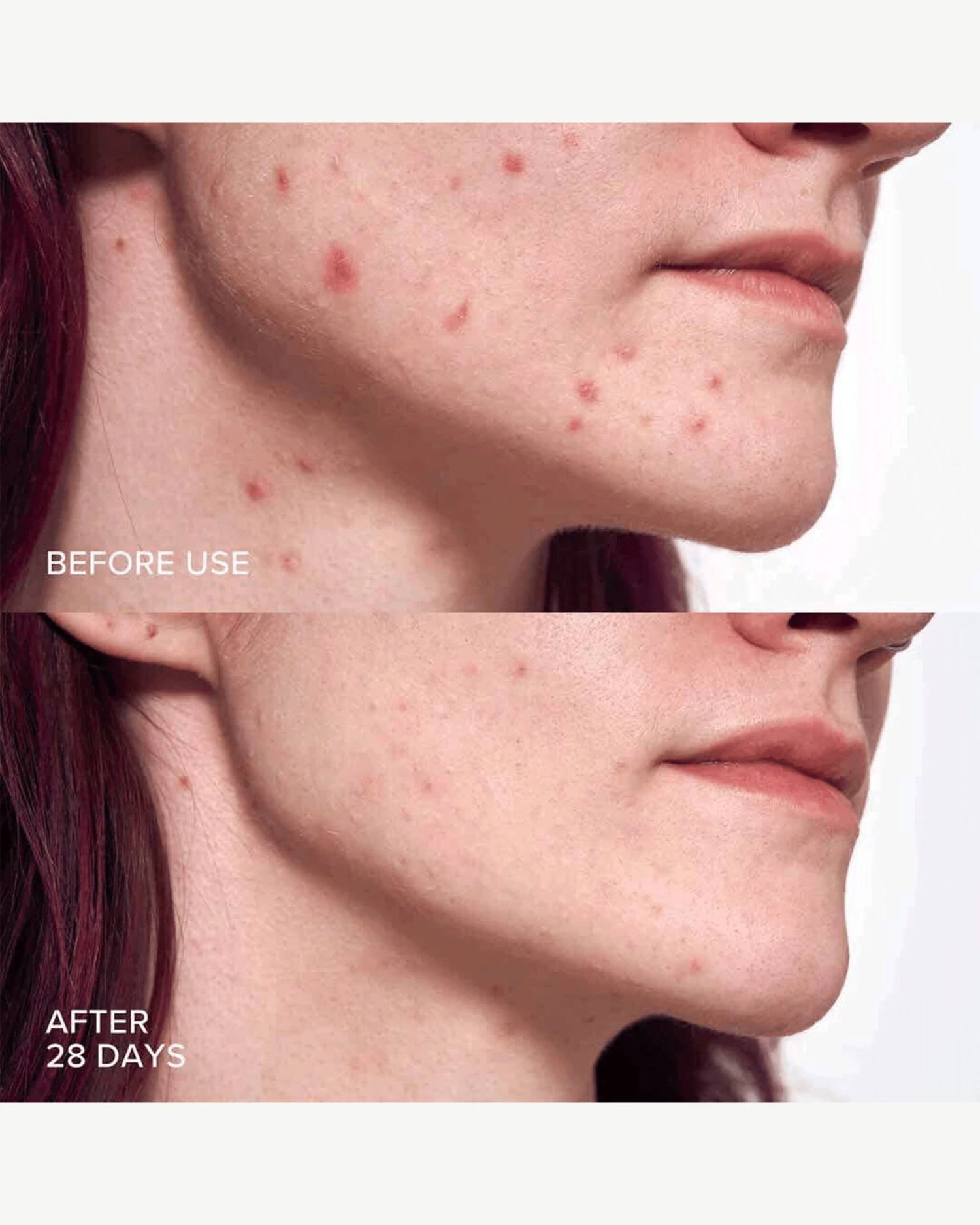 Pore Perfecting Liquid With 2% BHA + Borage 3 Pore Perfecting Liquid With 2% BHA + Borage - Image 3