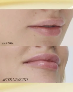 RMS Beauty Lipnights Overnight Lip Mask 10 RMS Beauty Lipnights Overnight Lip Mask -Fashion Makeup & Care RMS LipNightsOvernightMask BeforeAfter 04 scaled