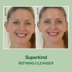 SUPERKIND Refining Cleanser 14 SUPERKIND Refining Cleanser -Fashion Makeup & Care RefiningCleanser