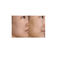 Resurfacing Serum 16 Resurfacing Serum -Fashion Makeup & Care ResurfacingSerum