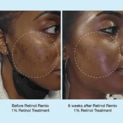 Retinol Remix 1% Retinol Treatment -Fashion Makeup & Care Retinolremix 1080x1080 04
