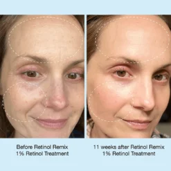 Retinol Remix 1% Retinol Treatment -Fashion Makeup & Care Retinolremix 1080x1080 08