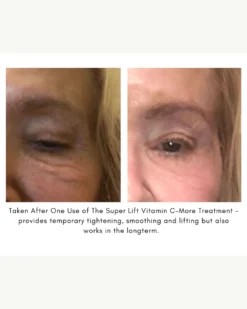 The Super Lift Vitamin C-More Treatment 19 The Super Lift Vitamin C-More Treatment -Fashion Makeup & Care SUPERLIFTCASESTUDY2