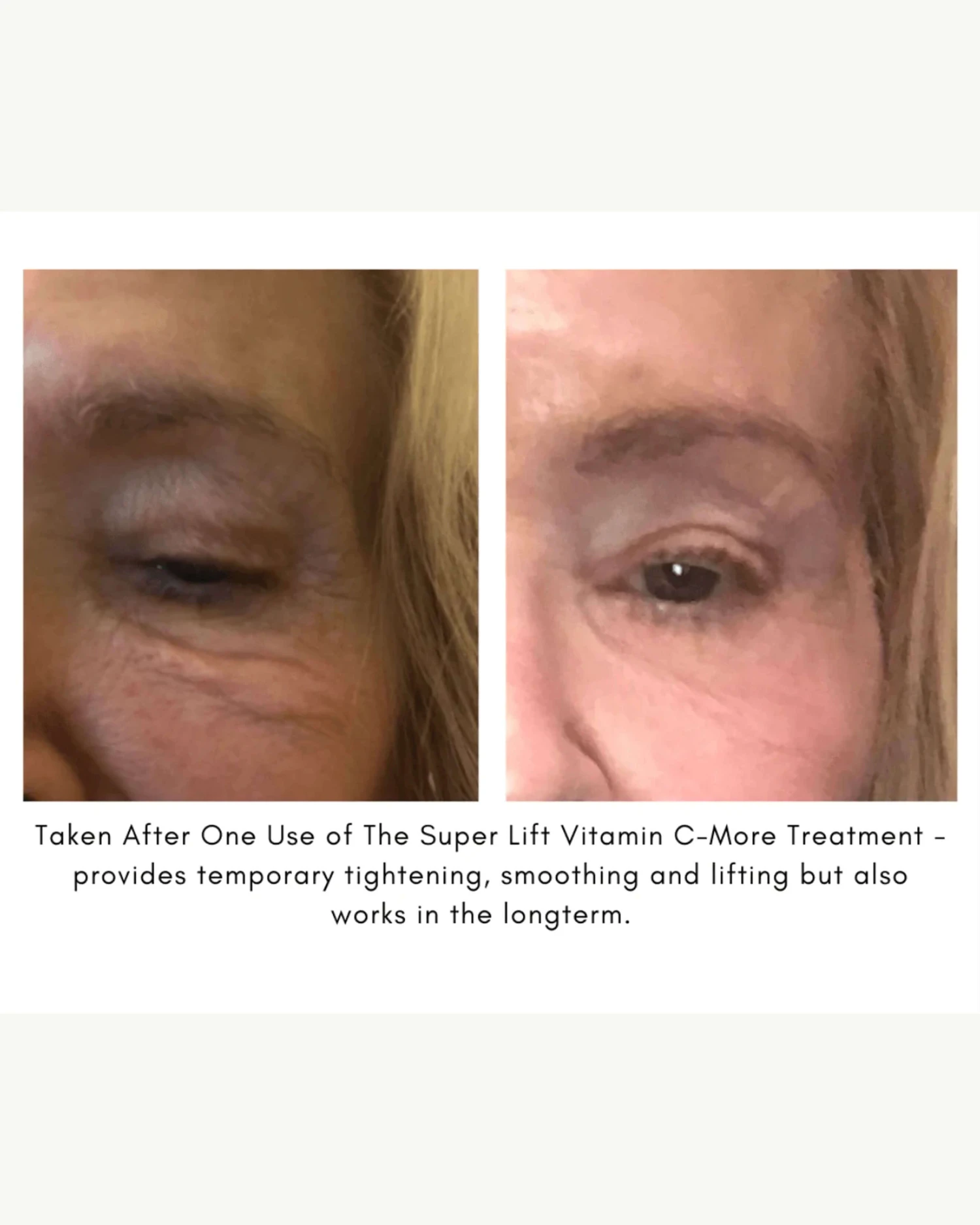 The Super Lift Vitamin C-More Treatment 9 The Super Lift Vitamin C-More Treatment - Image 9