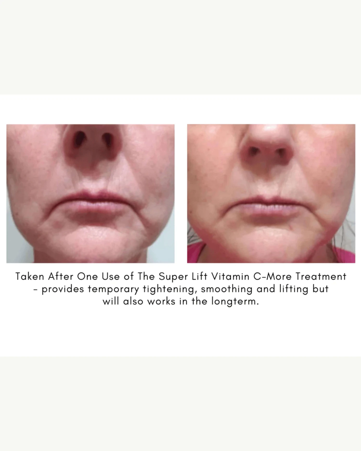 The Super Lift Vitamin C-More Treatment 11 The Super Lift Vitamin C-More Treatment - Image 11