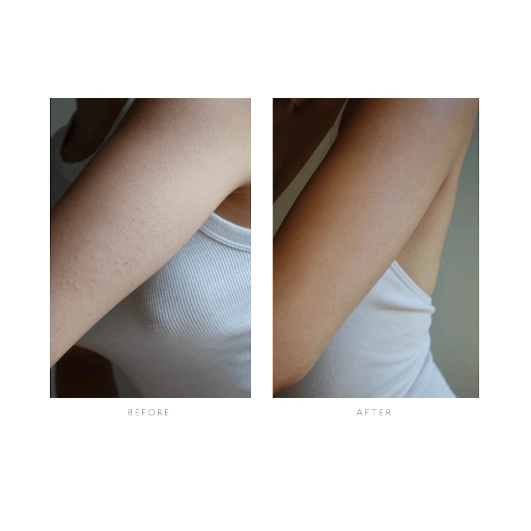 Resurfacing Body Serum 7 Resurfacing Body Serum - Image 7