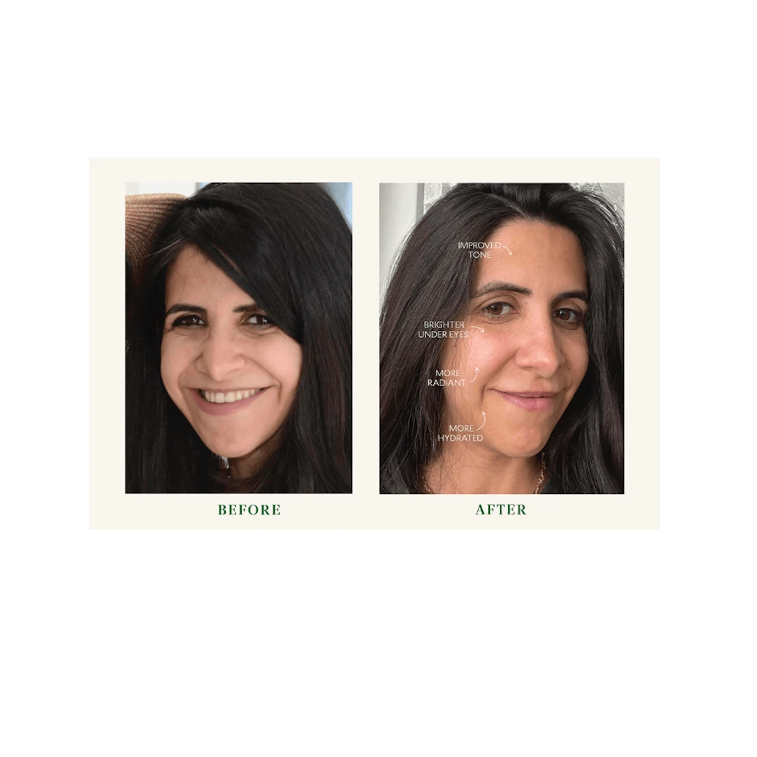 SUPERKIND Bio-Barrier Serum 4 SUPERKIND Bio-Barrier Serum - Image 4