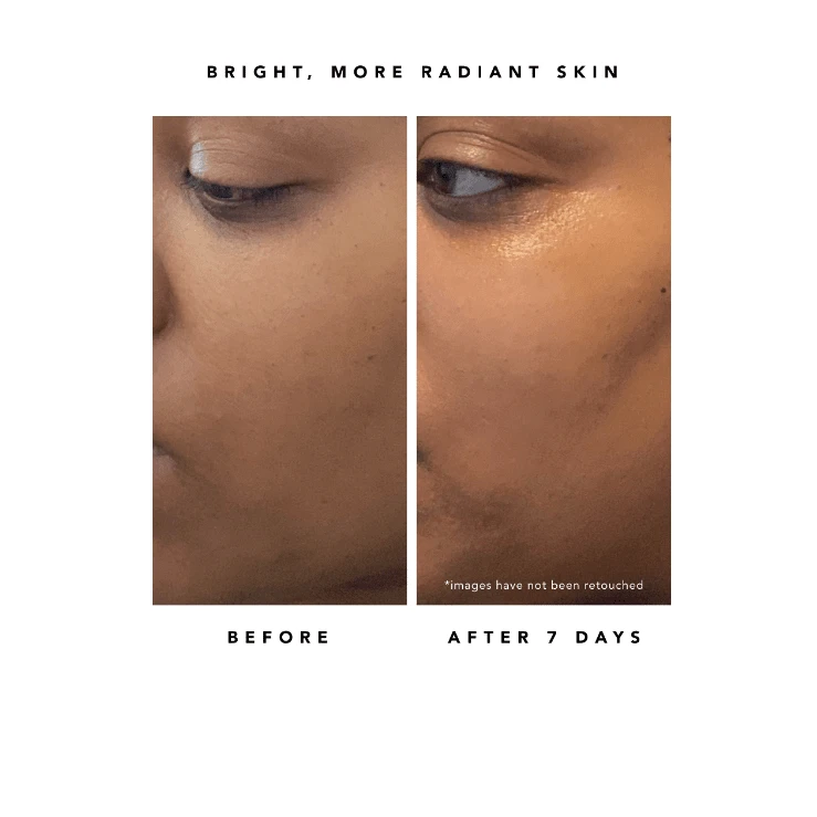 Nova 15% Vitamin C + Turmeric Brightening Serum 8 Nova 15% Vitamin C + Turmeric Brightening Serum - Image 8