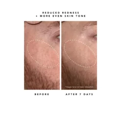 Nova 15% Vitamin C + Turmeric Brightening Serum 17 Nova 15% Vitamin C + Turmeric Brightening Serum -Fashion Makeup & Care ScreenShot2023 07 17at1.43.08PM