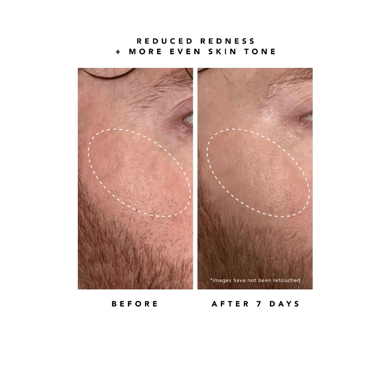 Nova 15% Vitamin C + Turmeric Brightening Serum 9 Nova 15% Vitamin C + Turmeric Brightening Serum - Image 9