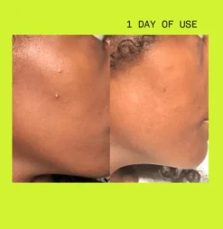 Pimple Paste Overnight Drying Paste -Fashion Makeup & Care TARASHOPIFY