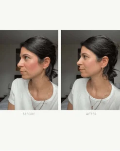 Regenerating Cleanser 15 Regenerating Cleanser -Fashion Makeup & Care TatHarper RegeneratingCleanser BeforeAfter 03 scaled