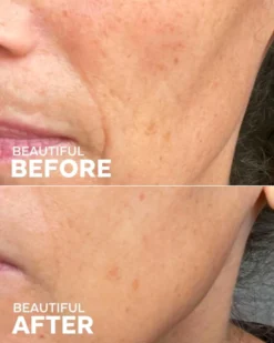 Boost 49% Rosehip Oil Serum -Fashion Makeup & Care ThreeShip BoostRosehipSerum BeforeAfter 04 scaled