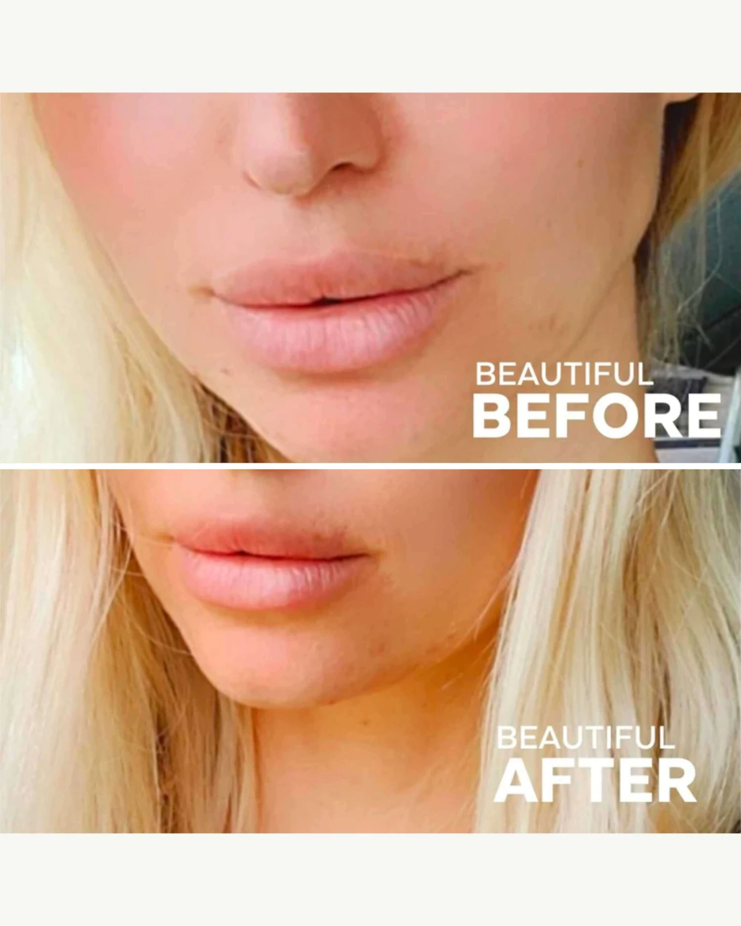 Buttercream Hydrating Lip Mask 5 Buttercream Hydrating Lip Mask - Image 5