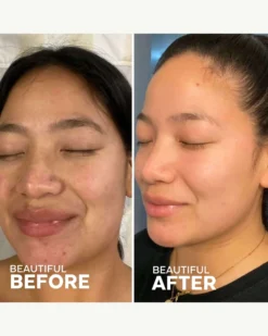 Dream Bio-Retinol + Shorea Butter Night Cream 11 Dream Bio-Retinol + Shorea Butter Night Cream -Fashion Makeup & Care ThreeShips DreamNightCream BeforeAfter 05 scaled