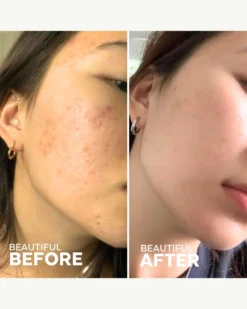 Purify Aloe + Amino Acid Cleanser -Fashion Makeup & Care ThreeShips PurifyAloeCleanser BeforeAfter 04 scaled
