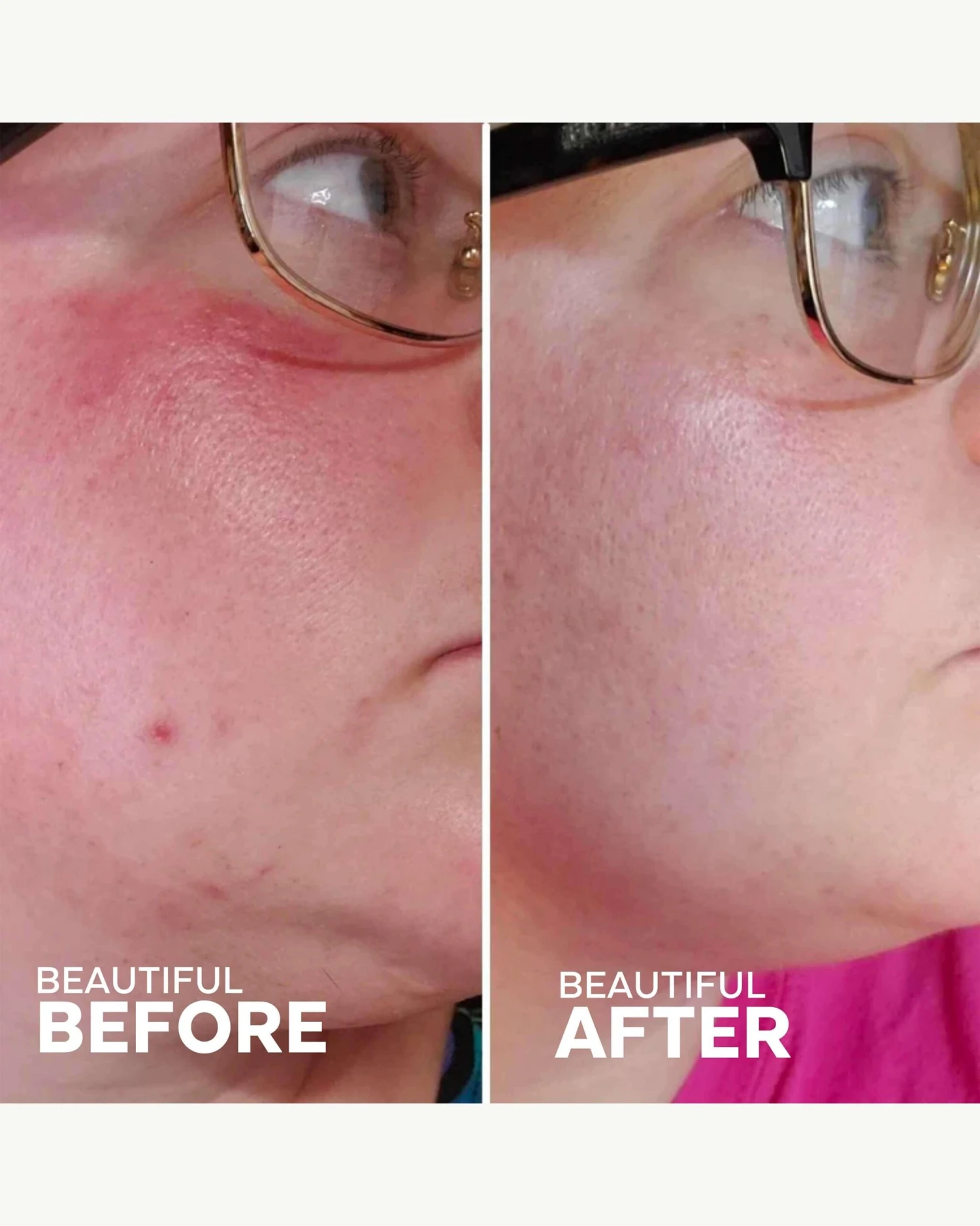 Radiance Grape Stem Cell + Squalane Day Cream 4 Radiance Grape Stem Cell + Squalane Day Cream - Image 4