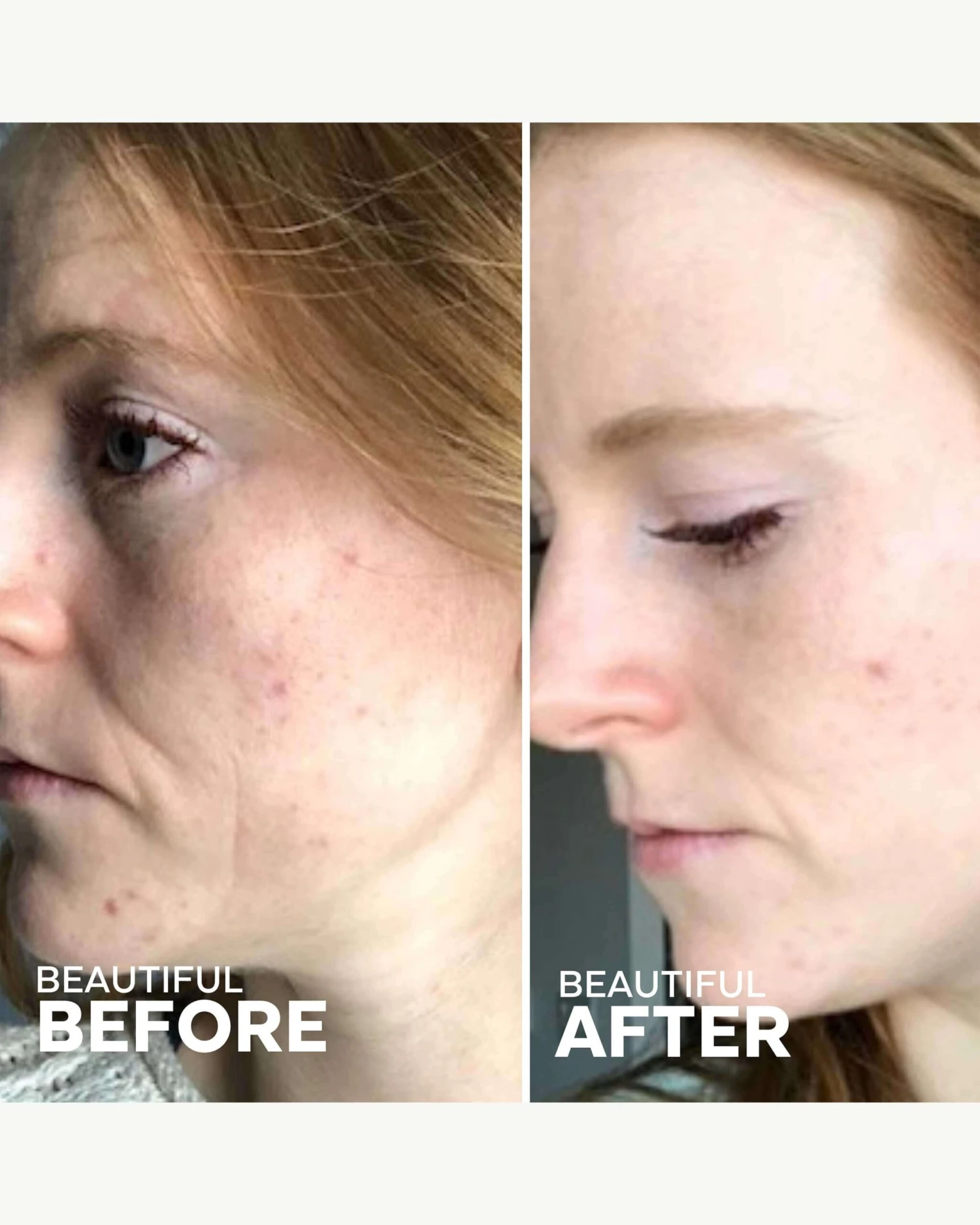 Refresh Papaya + Salicylic Acid Cleanser 5 Refresh Papaya + Salicylic Acid Cleanser - Image 5