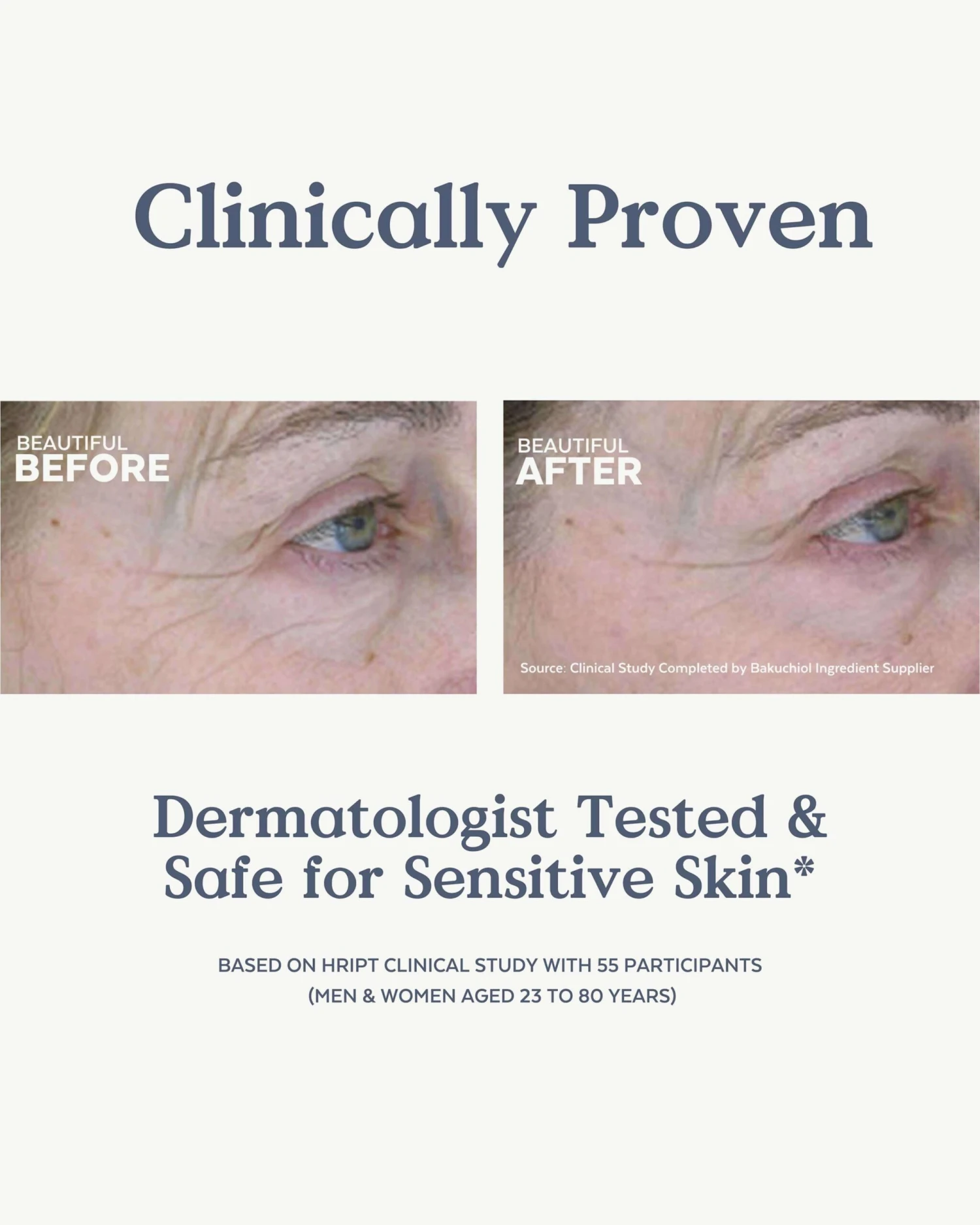 Skin Hero Bakuchiol + Calendula Bio-Retinol Serum 4 Skin Hero Bakuchiol + Calendula Bio-Retinol Serum - Image 4