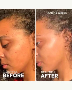 Superfruit Lactic + Multifruit 8% AHA Exfoliating Mask -Fashion Makeup & Care ThreeShips SuperfruitExfoliatingMask BeforeAfter 05 scaled