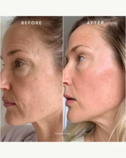 Glowy Bestsellers Starter Kit -Fashion Makeup & Care TrueBotanicals GlowyBestsellersKit BeforeAfter 04 scaled